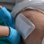 Preležaniny stoja zdravotníctvo milióny, prevencia ich dokáže výrazne znížiť