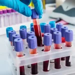 Slovenský test sľubuje rýchlejšie odhalenie rakoviny