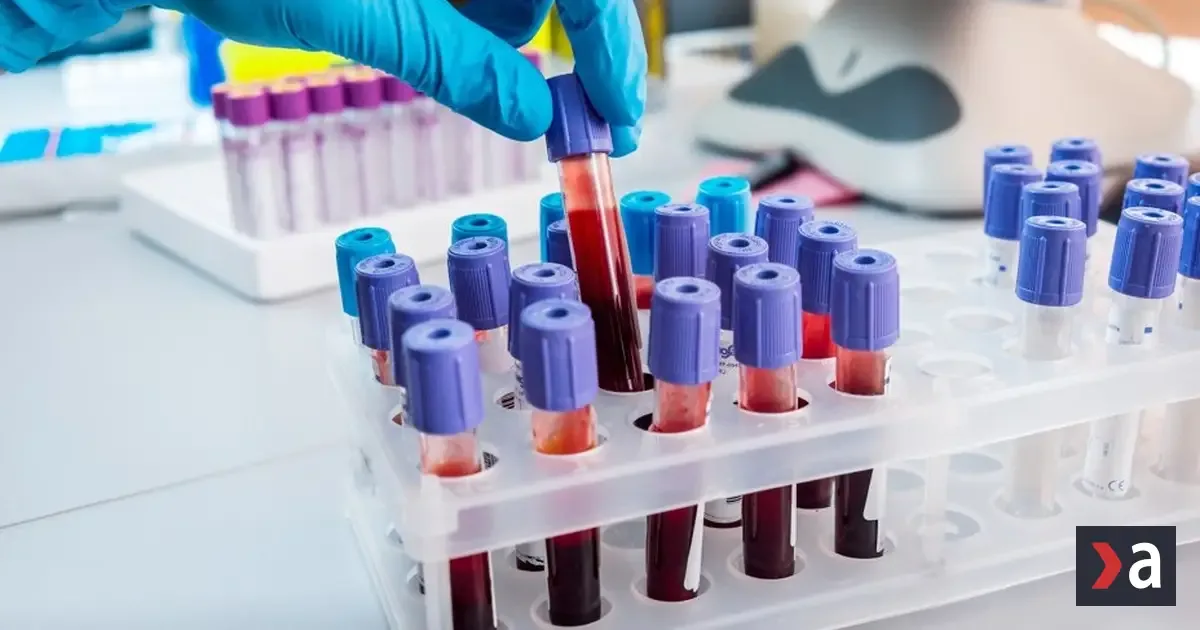 Slovenský test sľubuje rýchlejšie odhalenie rakoviny